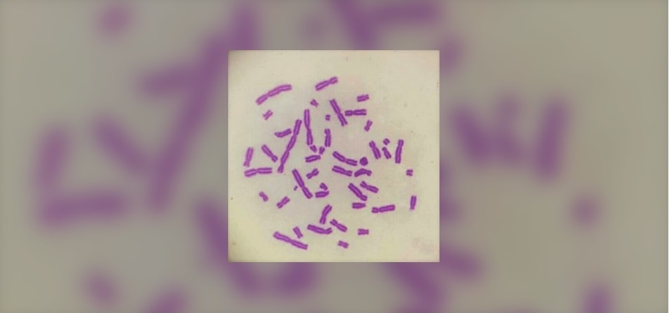 The 4th EURADOS WEBINAR -  Retrospective dosimetry techniques or internal exposures to ionizining radiation and their applications